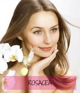 rosacea at Sparx Beauty Salon, Winchester